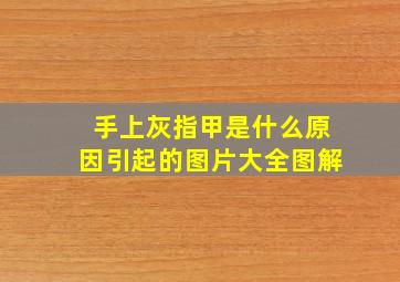 手上灰指甲是什么原因引起的图片大全图解