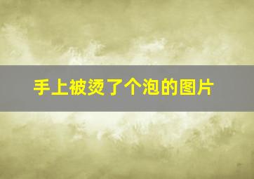 手上被烫了个泡的图片