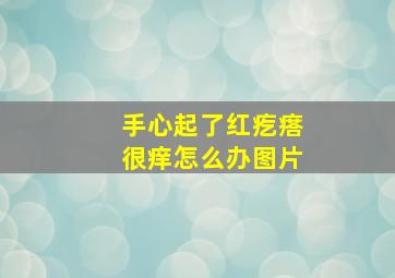 手心起了红疙瘩很痒怎么办图片