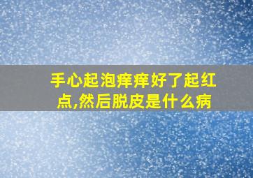 手心起泡痒痒好了起红点,然后脱皮是什么病