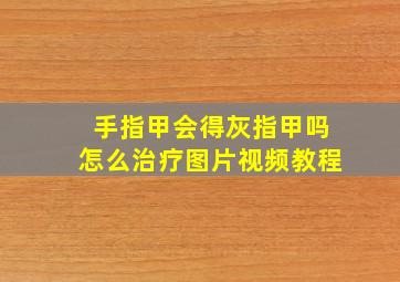 手指甲会得灰指甲吗怎么治疗图片视频教程