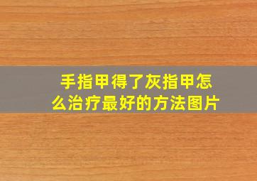 手指甲得了灰指甲怎么治疗最好的方法图片