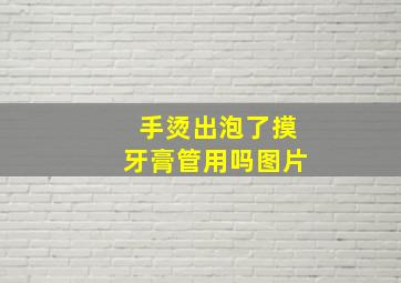 手烫出泡了摸牙膏管用吗图片