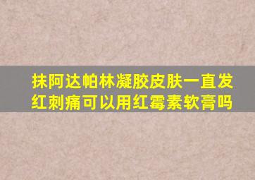 抹阿达帕林凝胶皮肤一直发红刺痛可以用红霉素软膏吗