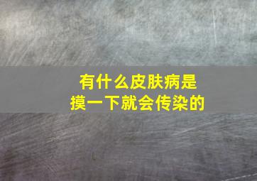 有什么皮肤病是摸一下就会传染的