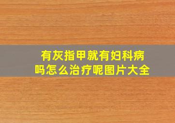 有灰指甲就有妇科病吗怎么治疗呢图片大全