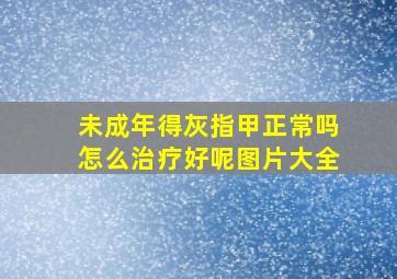 未成年得灰指甲正常吗怎么治疗好呢图片大全