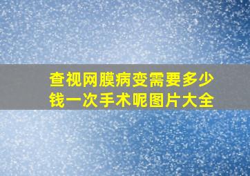 查视网膜病变需要多少钱一次手术呢图片大全