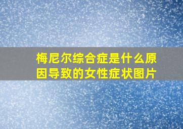 梅尼尔综合症是什么原因导致的女性症状图片