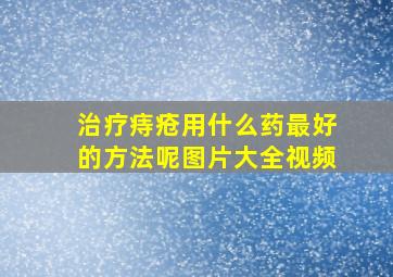 治疗痔疮用什么药最好的方法呢图片大全视频