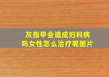 灰指甲会造成妇科病吗女性怎么治疗呢图片