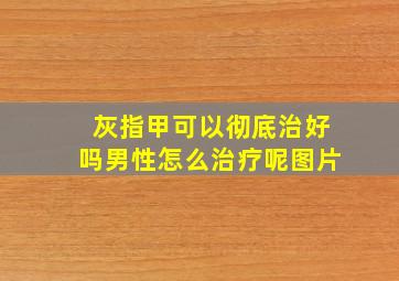 灰指甲可以彻底治好吗男性怎么治疗呢图片