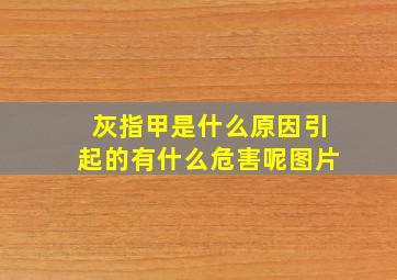 灰指甲是什么原因引起的有什么危害呢图片