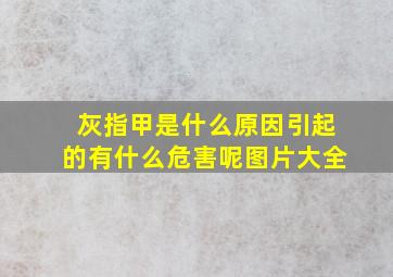 灰指甲是什么原因引起的有什么危害呢图片大全