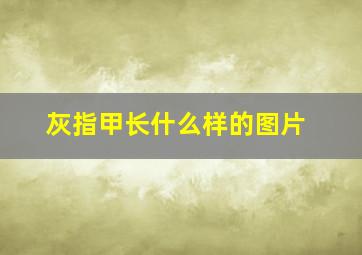 灰指甲长什么样的图片