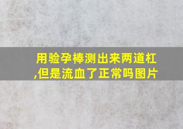 用验孕棒测出来两道杠,但是流血了正常吗图片