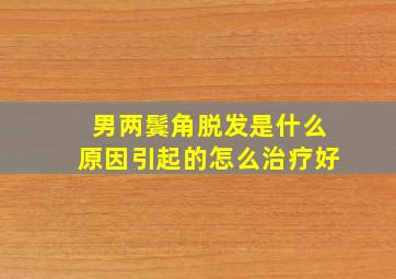 男两鬓角脱发是什么原因引起的怎么治疗好