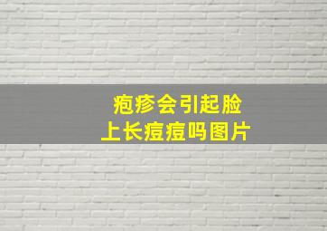 疱疹会引起脸上长痘痘吗图片