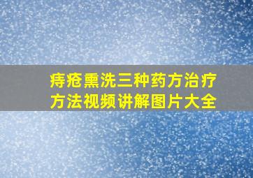 痔疮熏洗三种药方治疗方法视频讲解图片大全