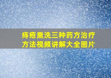 痔疮熏洗三种药方治疗方法视频讲解大全图片