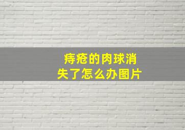 痔疮的肉球消失了怎么办图片