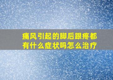 痛风引起的脚后跟疼都有什么症状吗怎么治疗