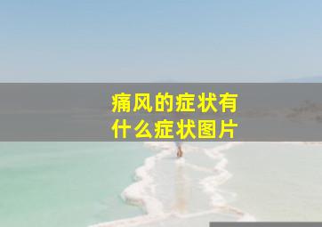 痛风的症状有什么症状图片