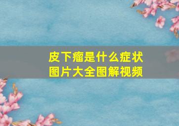 皮下瘤是什么症状图片大全图解视频