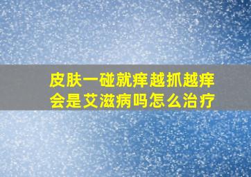 皮肤一碰就痒越抓越痒会是艾滋病吗怎么治疗