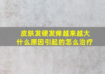 皮肤发硬发痒越来越大什么原因引起的怎么治疗