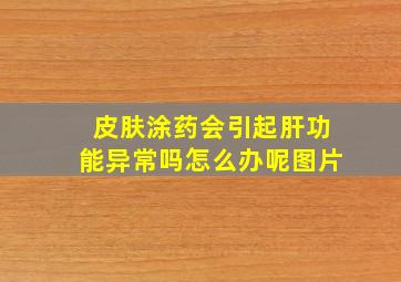 皮肤涂药会引起肝功能异常吗怎么办呢图片