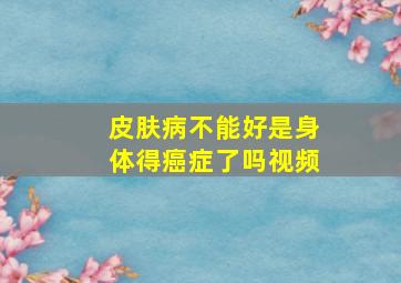 皮肤病不能好是身体得癌症了吗视频