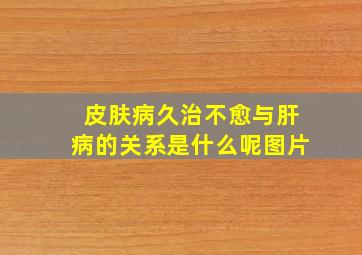 皮肤病久治不愈与肝病的关系是什么呢图片