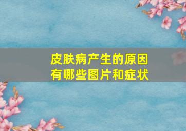 皮肤病产生的原因有哪些图片和症状