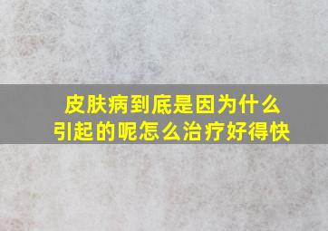 皮肤病到底是因为什么引起的呢怎么治疗好得快