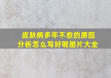 皮肤病多年不愈的原因分析怎么写好呢图片大全