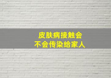 皮肤病接触会不会传染给家人