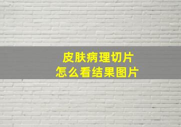 皮肤病理切片怎么看结果图片