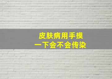 皮肤病用手摸一下会不会传染