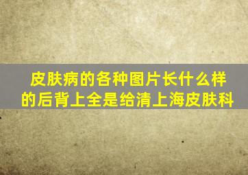 皮肤病的各种图片长什么样的后背上全是给清上海皮肤科