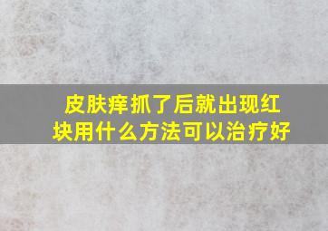 皮肤痒抓了后就出现红块用什么方法可以治疗好