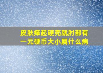 皮肤痒起硬壳就肘部有一元硬币大小属什么病