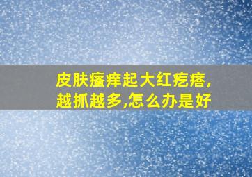 皮肤瘙痒起大红疙瘩,越抓越多,怎么办是好