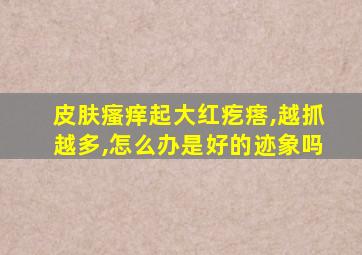 皮肤瘙痒起大红疙瘩,越抓越多,怎么办是好的迹象吗