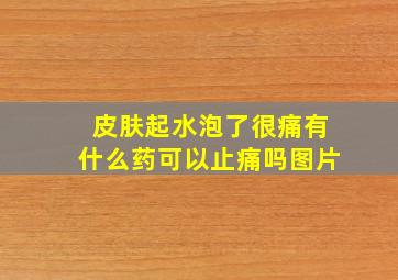 皮肤起水泡了很痛有什么药可以止痛吗图片