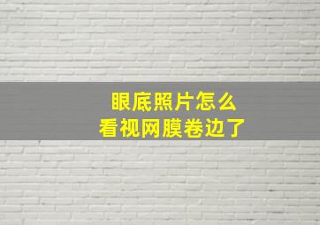 眼底照片怎么看视网膜卷边了