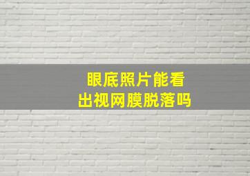 眼底照片能看出视网膜脱落吗