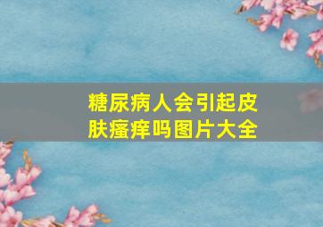 糖尿病人会引起皮肤瘙痒吗图片大全