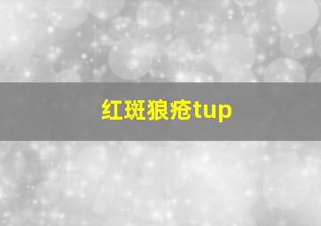 红斑狼疮tup