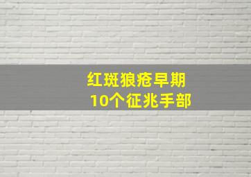 红斑狼疮早期10个征兆手部